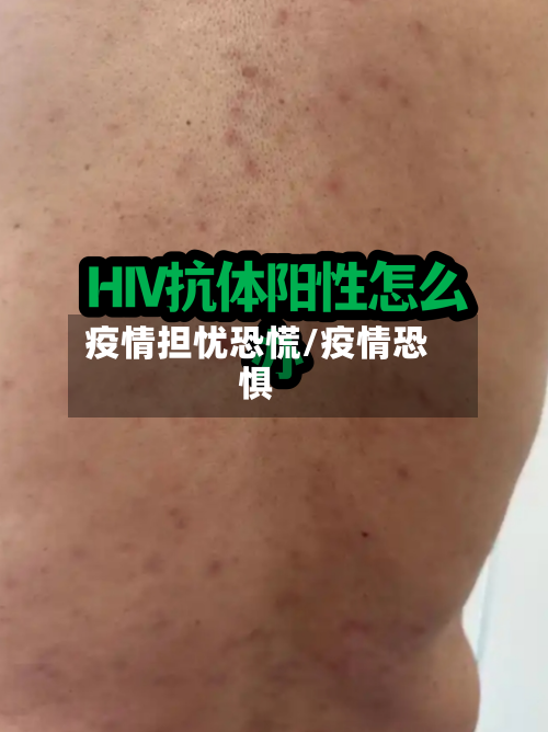 疫情担忧恐慌/疫情恐惧-第2张图片