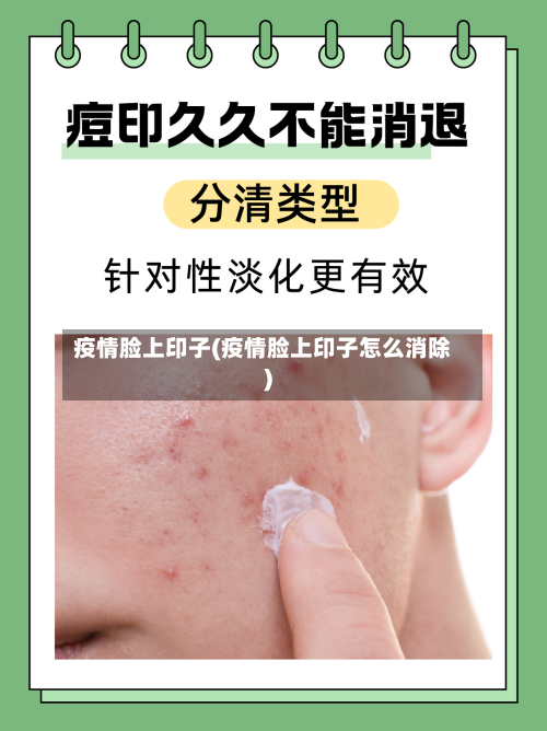 疫情脸上印子(疫情脸上印子怎么消除)